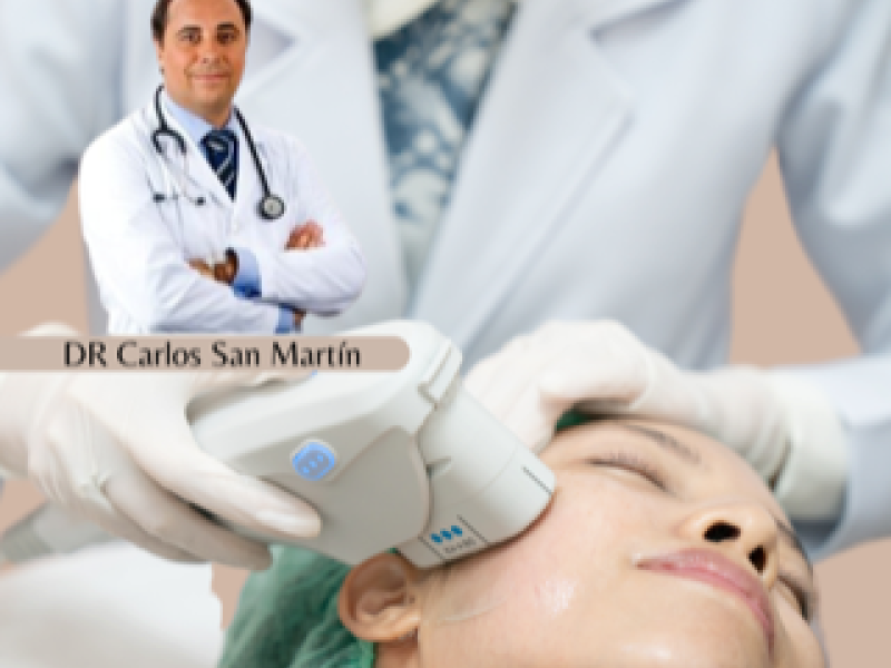 Fotomontaje report Ultherapy Mayo 2023 4