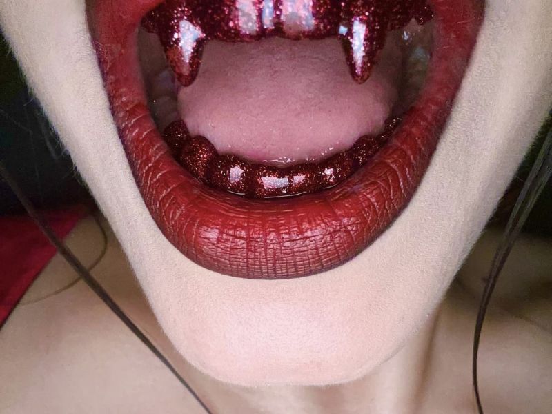 Joyas dentales